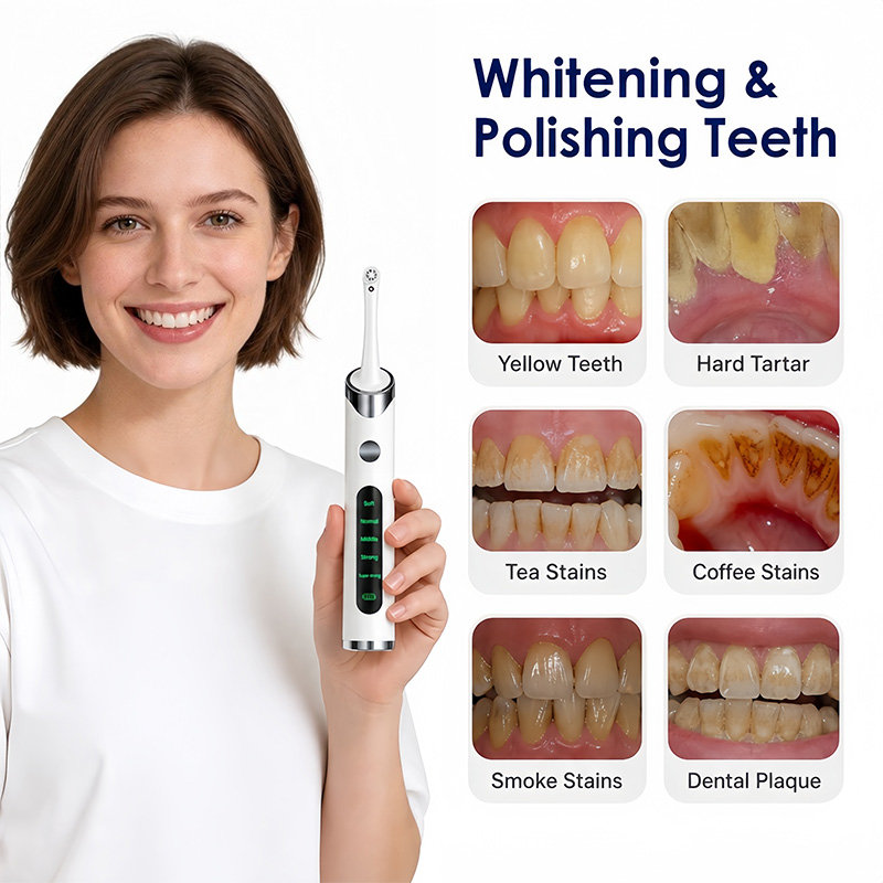 Teeth Whitening Kit With Light - 치아 광택기 치아 미백 키트, 치아