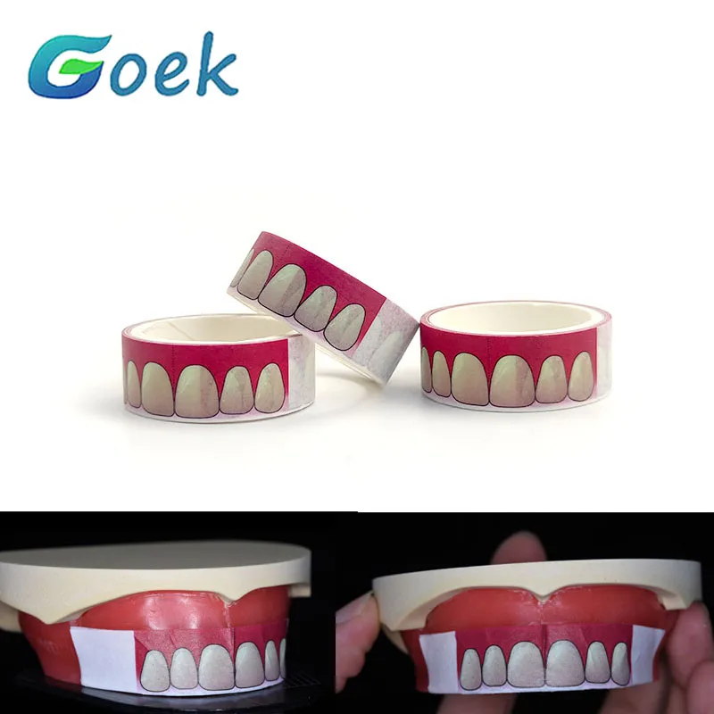 Teeth Whitening Tray - 치과용 전체 앞니 위치 스티커 도구,