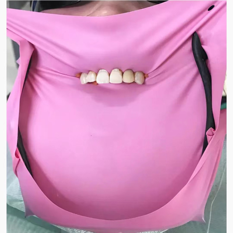 1/36개 치과용 라텍스 댐 시트 6인치X6인치 천연  - Teeth Whitening Naturally 리뷰 및 가격