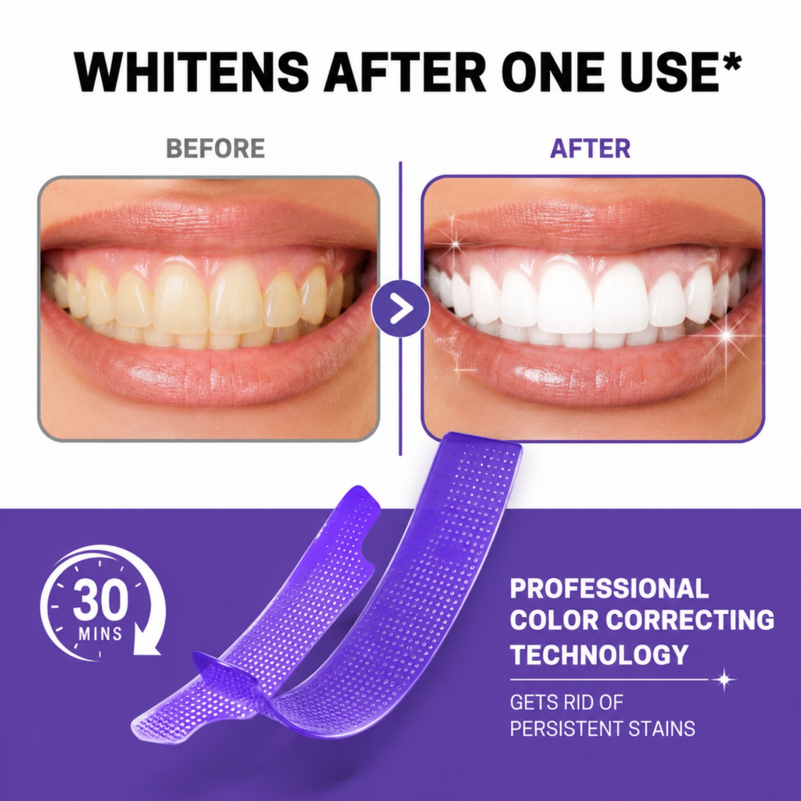 7/14/21/28개입 퍼플 치아 미백 스트립 3D 핏 - Whitening Strip 3D 리뷰 및 가격