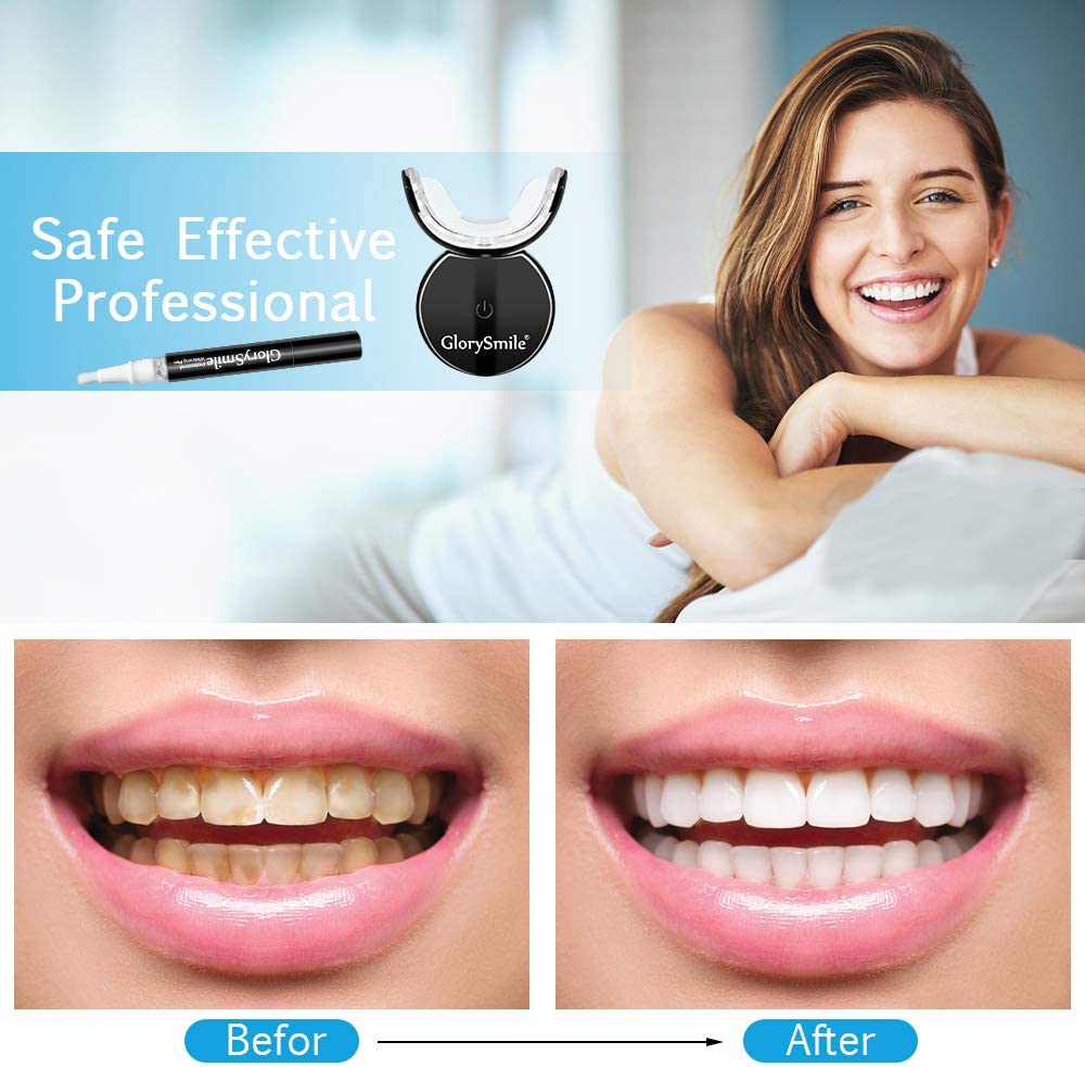 글로리스마일 살롱 무과산화수소 무선 32구 LED 치아 - Teeth Whitening Led Kit 리뷰 및 가격