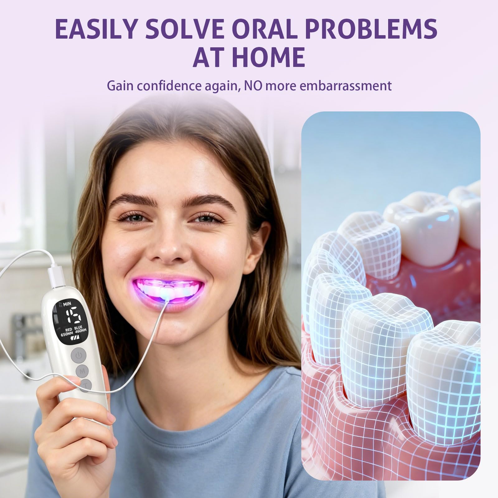 빨간색 파란색 광선 치료 치아 미백 기기 650nm 4 - Teeth Whitening Led Kit 리뷰 및 가격