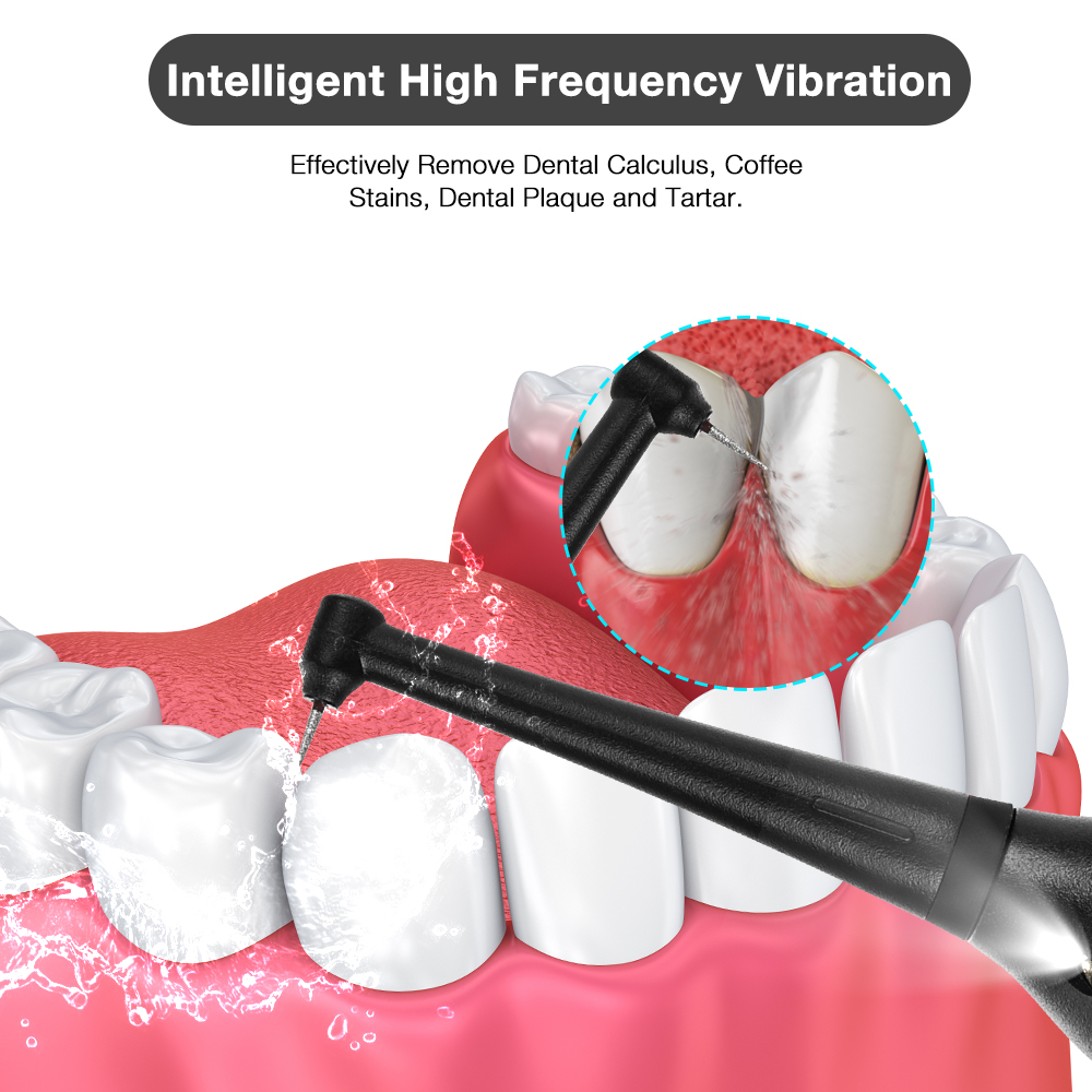 LED 전기 음파 스케일러 칫솔 세트 얼룩 치과 미적분 - Teeth Whitening Led Kit 리뷰 및 가격