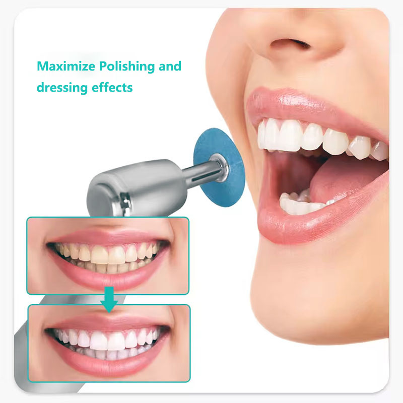 40개 치과용 폴리싱 디스크 홀딩 로드 맨드렐 소플렉스 - Teeth Whitening Express 리뷰 및 가격
