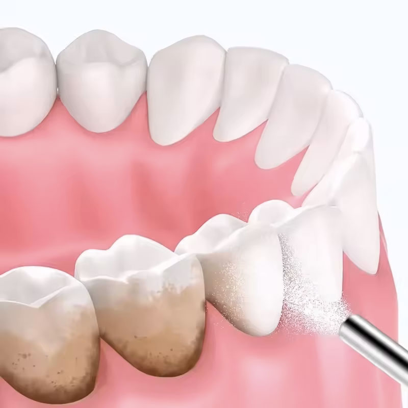 130g 치아 샌드블라스팅 파우더 치아 미백 파우더 샌 - Teeth Whitening Co 리뷰 및 가격