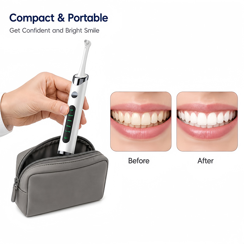 치아 광택기 치아 미백 키트, 치아 청소 및 미백용,  - Teeth Whitening Kit With Light 리뷰 및 가격
