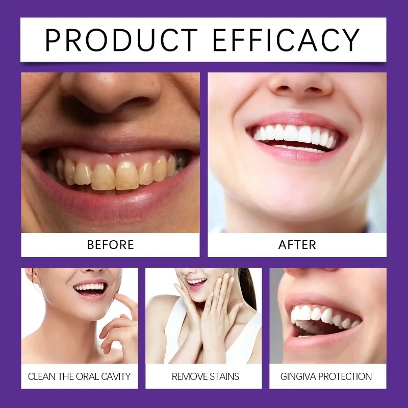 퍼플 치아 복원 미네랄 파우더 브라이트닝 화이트닝 에나 - Teeth Whitening Co 리뷰 및 가격
