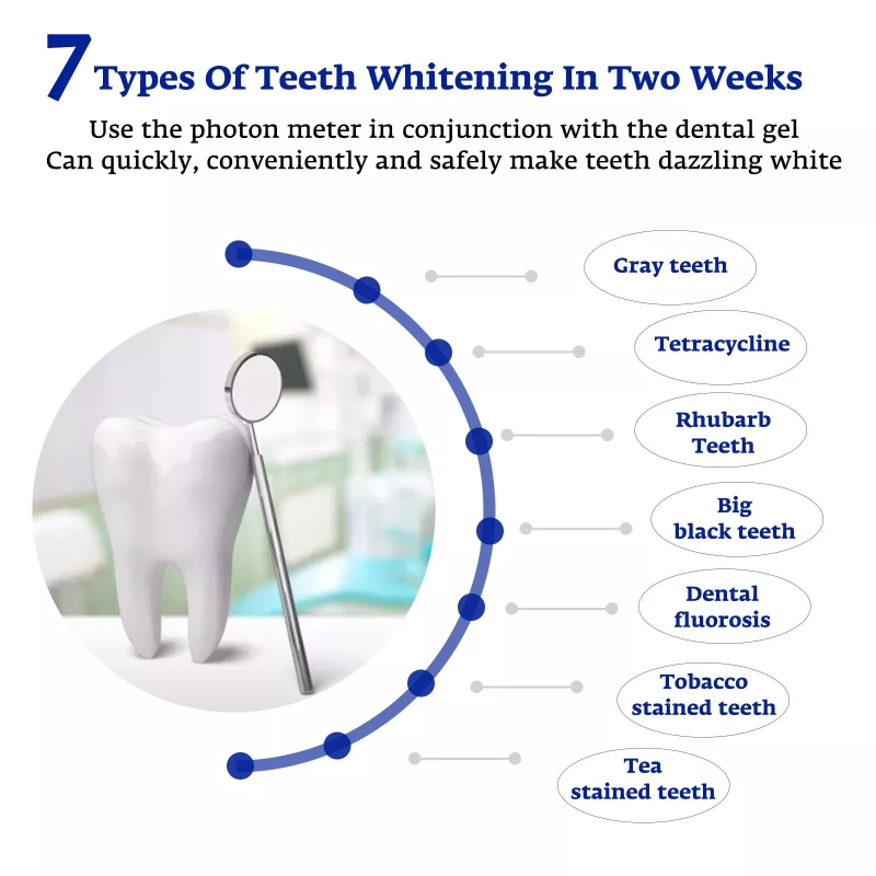 치아 미백 가속기 스마트 LED 블루 라이트 휴대용 U - Teeth Whitening Led Kit 리뷰 및 가격