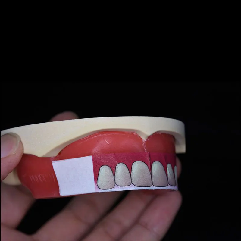 치과용 전체 앞니 위치 스티커 도구, 흡수성 가짜 치아 - Teeth Whitening Tray 리뷰 및 가격